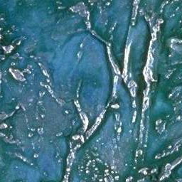 Wall