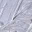 Stucco