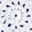 Doily