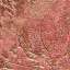 Stucco