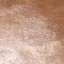 Stucco