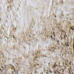 Stucco