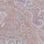 Textile