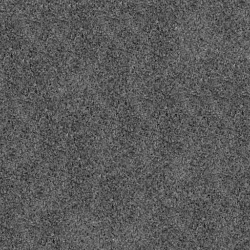 Noise