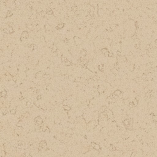 Stucco